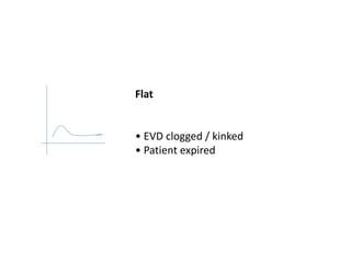 Flat
• EVD clogged / kinked
• Patient expired
 