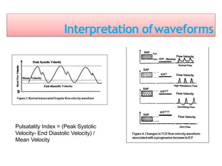 Interpretation ofwaveforms
Pulsatality Index = (Peak Systolic
Velocity- End Diastolic Velocity) /
Mean Velocity
 