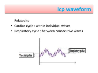 Icp waveform
 