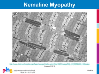 Nemaline Myopathy




http://www.childrenshospital.org/cfapps/research/data_admin/Site1694/Images/S93-1497EM25039_490px.jpg
                                           Accessed 9/20/10


                                                                                                 15 of 56
 
