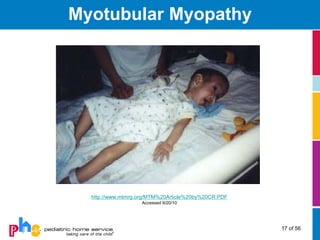 Myotubular Myopathy




  http://www.mtmrg.org/MTM%20Article%20by%20CR.PDF
                   Accessed 9/20/10




                                                     17 of 56
 