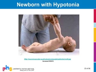 Newborn with Hypotonia




  http://neuromuscular.wustl.edu/pics/people/patients/cmdl.jpg
                         Accessed 9/20/10




                                                                 23 of 56
 