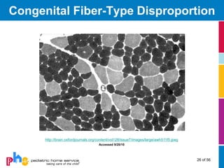 Congenital Fiber-Type Disproportion




      http://brain.oxfordjournals.org/content/vol128/issue7/images/large/awh511f5.jpeg
                                      Accessed 9/20/10



                                                                                         26 of 56
 