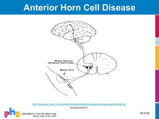 Anterior Horn Cell Disease




 http://www.ott.zynet.co.uk/polio/lincolnshire/library/gawne/images/pandcmfig3.gif
                                 Accessed 9/20/10

                                                                                     38 of 56
 
