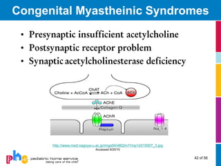 Congenital Myastheinic Syndromes
 • Presynaptic insufficient acetylcholine
 • Postsynaptic receptor problem
 • Synaptic acetylcholinesterase deficiency




         http://www.med.nagoya-u.ac.jp/imgs04/i4l02m11mp1d310007_3.jpg
                                Accessed 9/20/10

                                                                         42 of 56
 