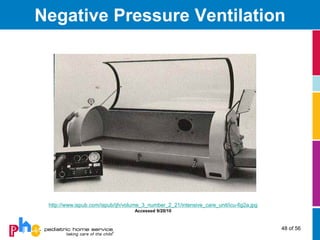 Negative Pressure Ventilation




 http://www.ispub.com/ispub/ijh/volume_3_number_2_21/intensive_care_unit/icu-fig2a.jpg
                                    Accessed 9/20/10



                                                                                         48 of 56
 