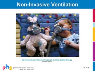 Non-Invasive Ventilation




 http://www.mda.org/publications/images/q11-3_Taleah_English-SMA.jpg
                           Accessed 9/20/10



                                                                       54 of 56
 