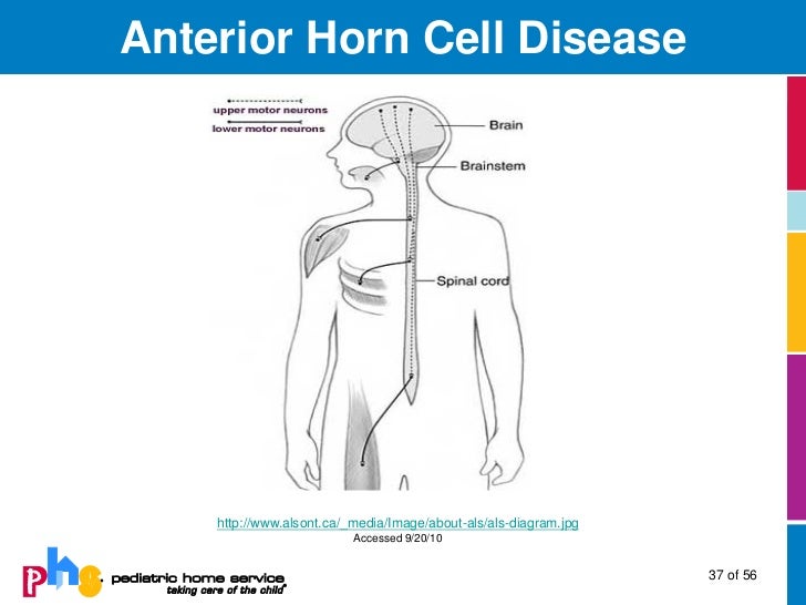 Neuromuscular Diseases