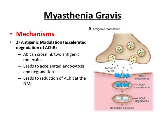 Pyridostigmine Test Myasthenia Gravis Pyridostigmine Test Myasthenia Gravis