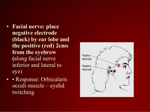 Nerve impulse transmission occurring along myelinated neurons are called