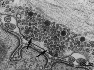 Synapse from a frog sartorius neuromuscular
junction showing vesicles clustered in the active
zone, some docked at the membrane (arrows).
(from
Heuser,
1977)

 