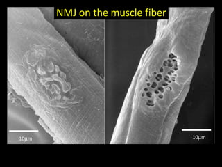 NMJ on the muscle fiber

10µm

10µm

 