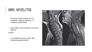 MRI: MYELITIS
 Increased signal change on T2-
weighted imaging spanning >3
vertebral segments(A)
 Also called Long Extended Transverse
Myelitis
(LETM)
 T1-weighted cervical-spine MRI
following gadolinium(B)
 