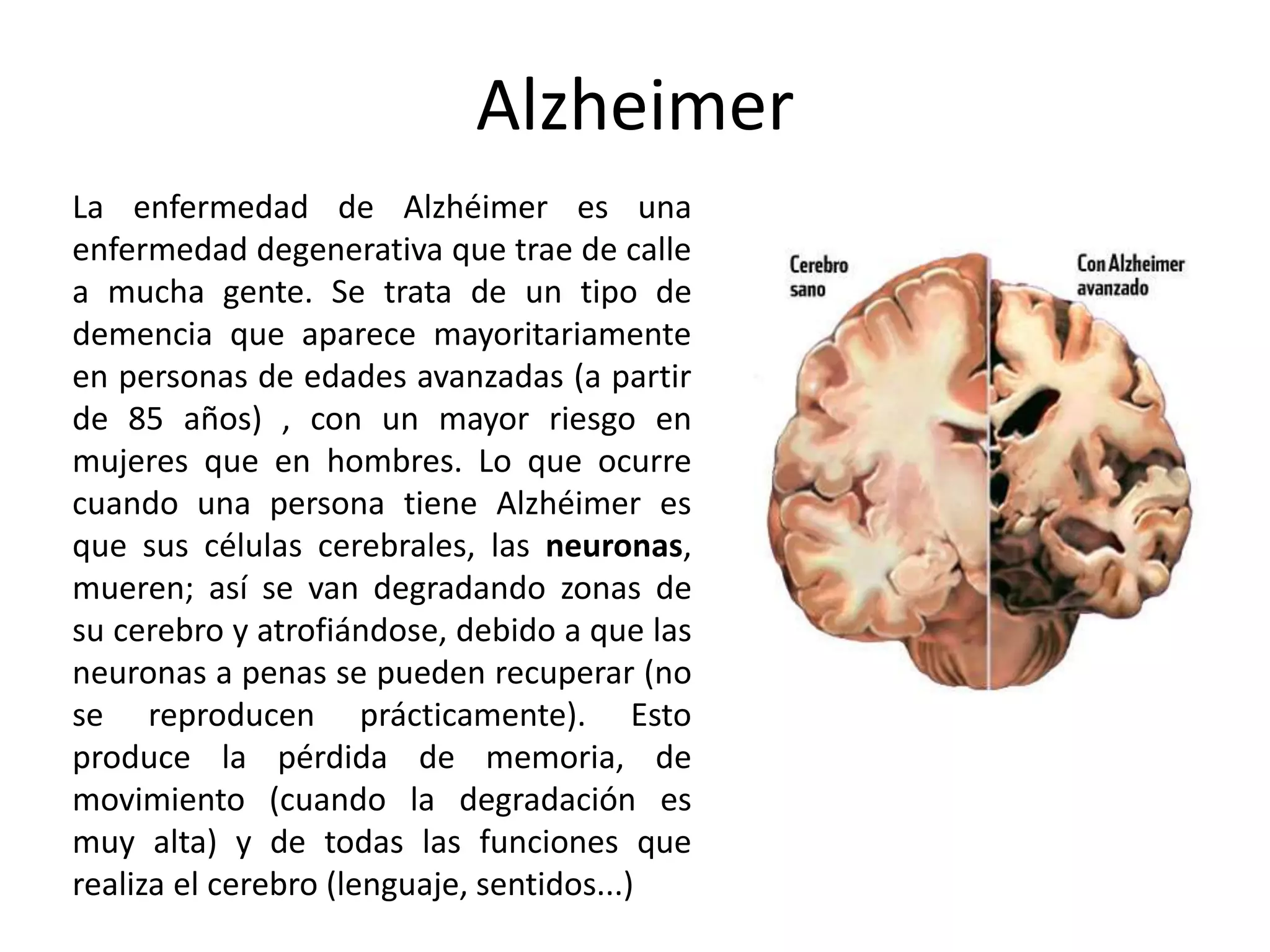 Alzheimer
La enfermedad de Alzhéimer es una
enfermedad degenerativa que trae de calle
a mucha gente. Se trata de un tipo de
demencia que aparece mayoritariamente
en personas de edades avanzadas (a partir
de 85 años) , con un mayor riesgo en
mujeres que en hombres. Lo que ocurre
cuando una persona tiene Alzhéimer es
que sus células cerebrales, las neuronas,
mueren; así se van degradando zonas de
su cerebro y atrofiándose, debido a que las
neuronas a penas se pueden recuperar (no
se reproducen prácticamente). Esto
produce la pérdida de memoria, de
movimiento (cuando la degradación es
muy alta) y de todas las funciones que
realiza el cerebro (lenguaje, sentidos...)
 