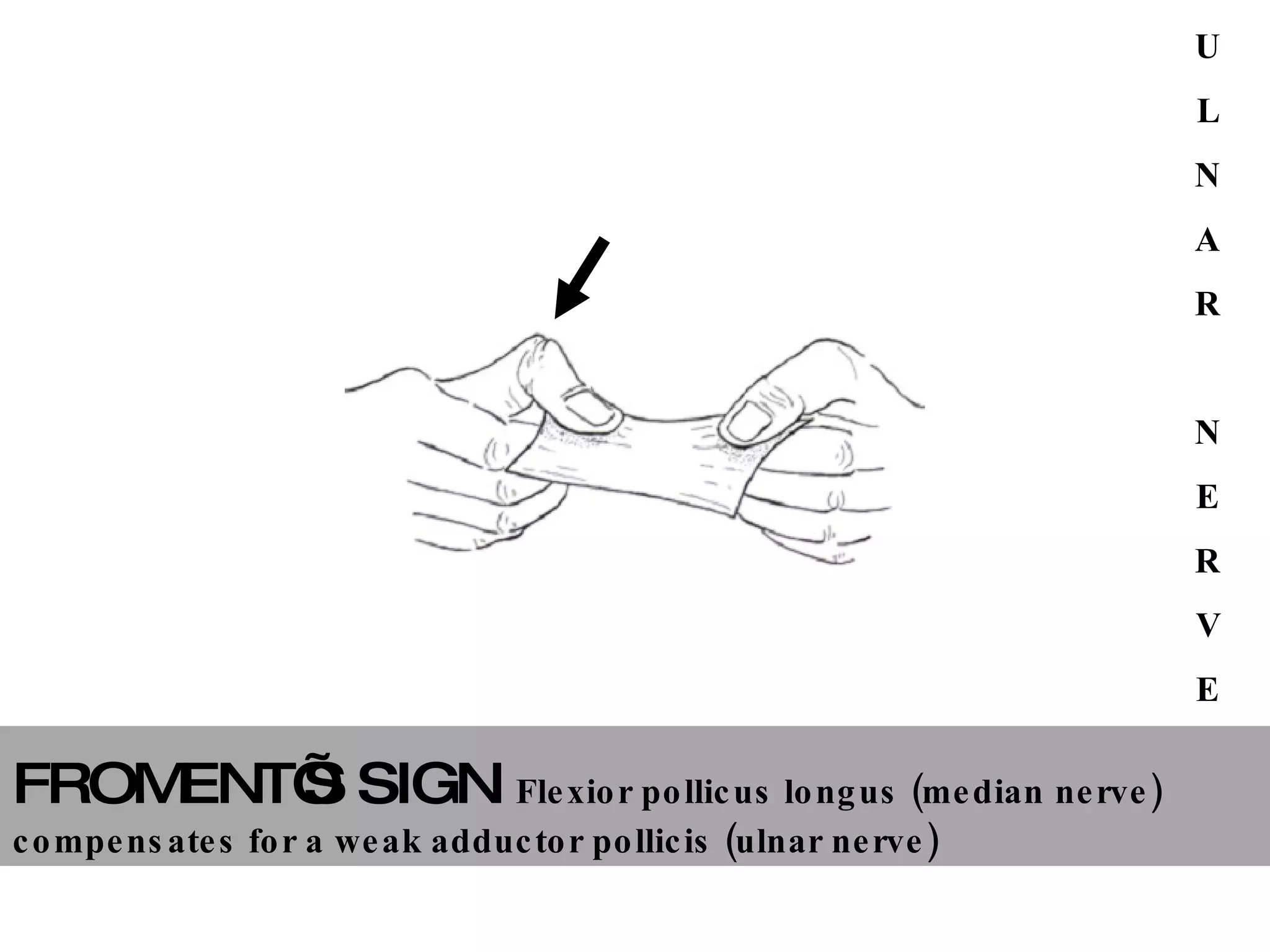 peripheral nerve lesions | PPT