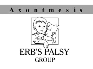 A  x  o  n  t  m  e  s  i  s 