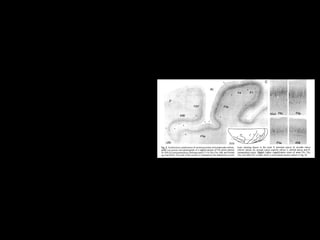 64
45B
Area prefrontale
attivata insieme
a 45A e 46
Si attiva sia con
l’osservazione
dell’azione che
con
l’osservazione
di immagini di
oggetti
L’associazi
one tra
forma e
azione fa sì
che la si
possa
considerare
un’ “unione
prelinguisti
ca”tra verbo e oggetto
 