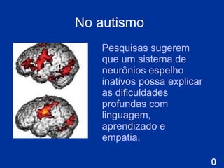 No autismo   Pesquisas sugerem que um sistema de neurônios espelho inativos possa explicar as dificuldades profundas com linguagem, aprendizado e empatia.                                                  