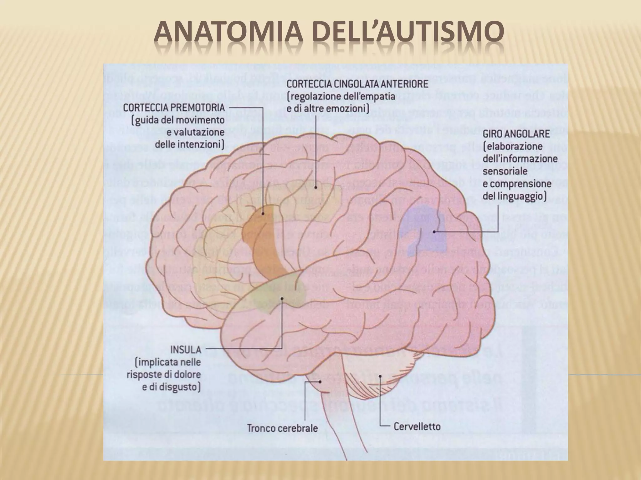 ANATOMIA DELL’AUTISMO
 