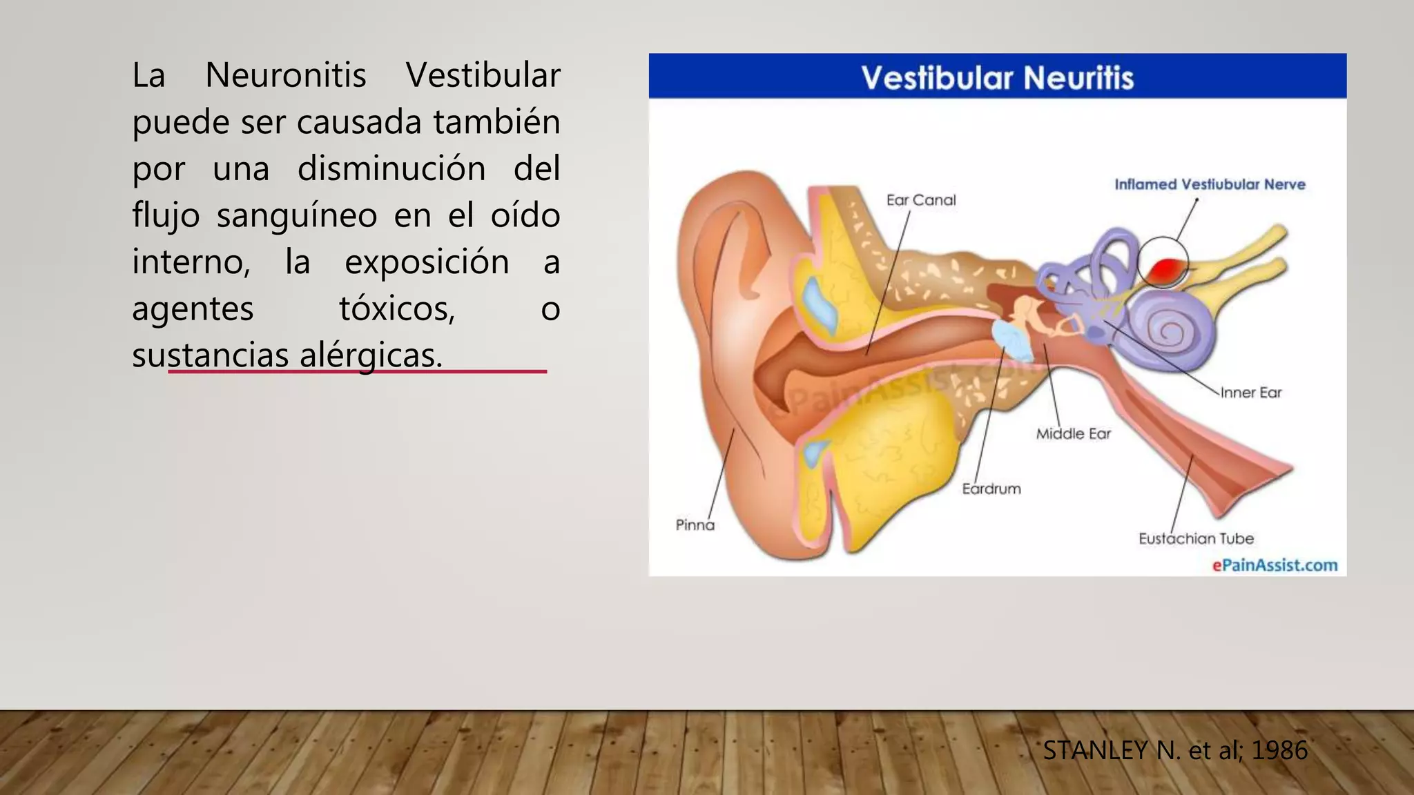Neuronitis Neuronitis vestibular | PPTX