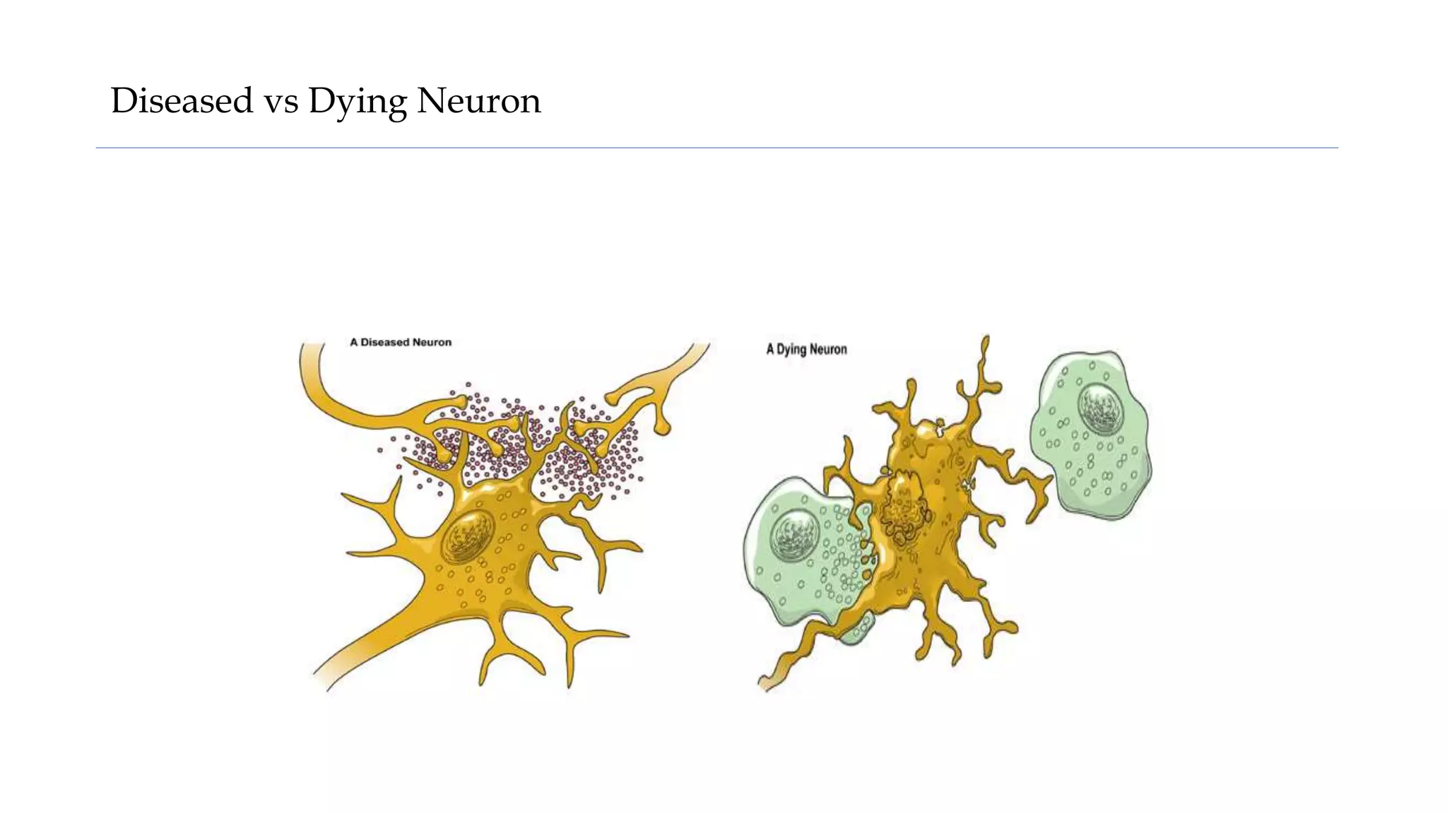 Diseased vs Dying Neuron
 