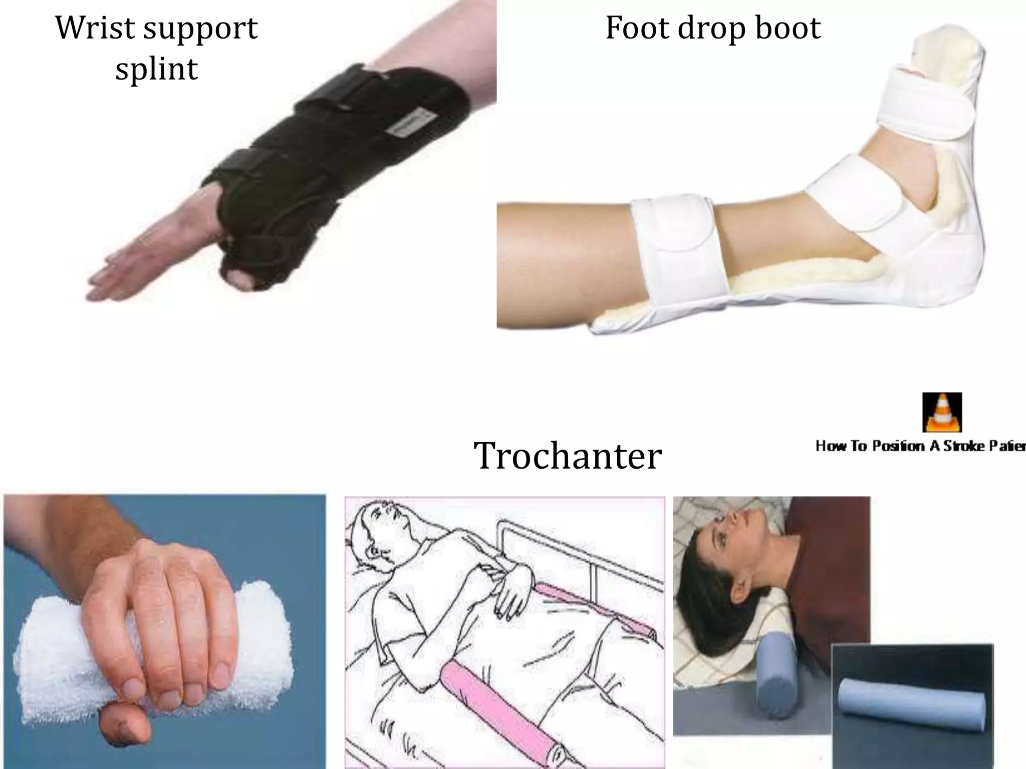 rehabilitation of neurological patients | PPTX