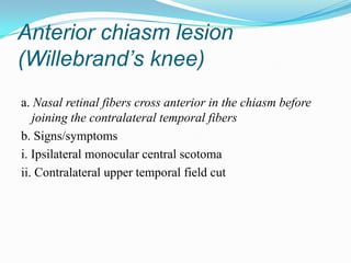 Anterior chiasm lesion
(Willebrand’s knee)
a. Nasal retinal fibers cross anterior in the chiasm before
   joining the contralateral temporal fibers
b. Signs/symptoms
i. Ipsilateral monocular central scotoma
ii. Contralateral upper temporal field cut
 