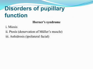 Disorders of pupillary
function
                    Horner’s syndrome
i. Miosis
ii. Ptosis (denervation of Müller’s muscle)
iii. Anhidrosis (ipsilateral facial)
 