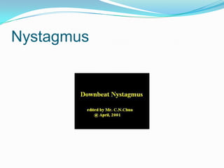 Nystagmus
 