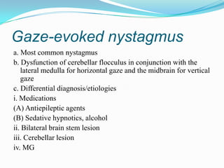 Gaze-evoked nystagmus
a. Most common nystagmus
b. Dysfunction of cerebellar flocculus in conjunction with the
   lateral medulla for horizontal gaze and the midbrain for vertical
   gaze
c. Differential diagnosis/etiologies
i. Medications
(A) Antiepileptic agents
(B) Sedative hypnotics, alcohol
ii. Bilateral brain stem lesion
iii. Cerebellar lesion
iv. MG
 