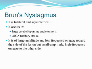 Brun's Nystagmus
 It is bilateral and asymmetrical.
 It occurs in:
    large cerebellopontine angle tumors.
    AICA territory stroke.
 It is of large-amplitude and low frequency on gaze toward
  the side of the lesion but small-amplitude, high-frequency
  on gaze to the other side.
 