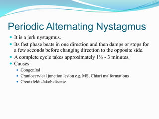 Periodic Alternating Nystagmus
 It is a jerk nystagmus.
 Its fast phase beats in one direction and then damps or stops for
  a few seconds before changing direction to the opposite side.
 A complete cycle takes approximately 1½ - 3 minutes.
 Causes:
    Congenital
    Craniocervical junction lesion e.g. MS, Chiari malformations
    Creutzfeldt-Jakob disease.
 