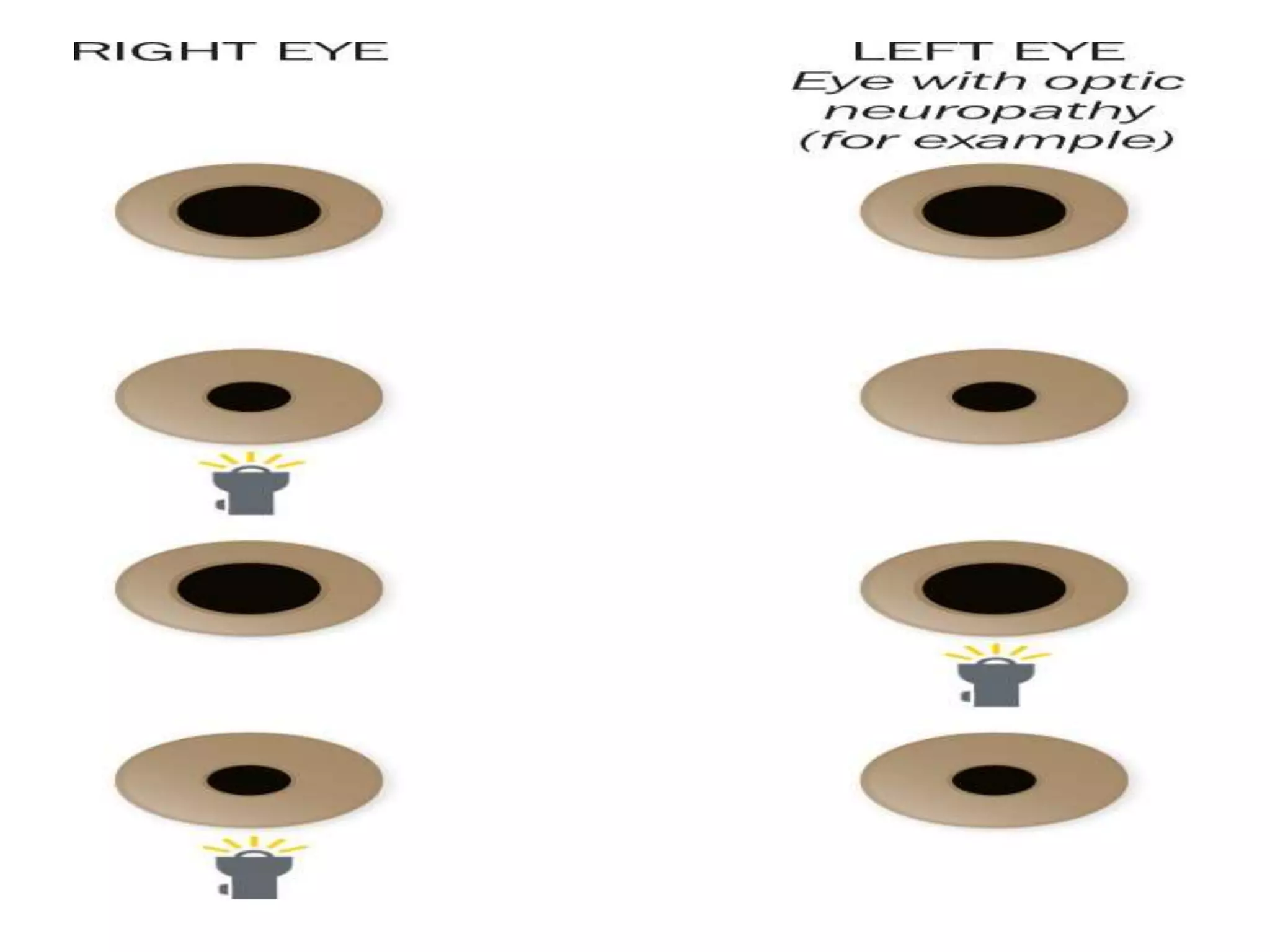 Neuro ophthalmology Basics | PPTX