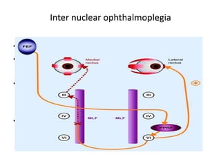 Pons Ino Neuro ophthalmology Basics | PPTX