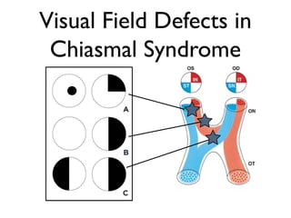 Neuro-Ophthalmic Emergencies | PPS