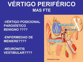 VÉRTIGO PERIFÉRICO MAS FTE -VÉRTIGO POSICIONAL PAROXÍSTICO  BENIGNO ???? -ENFERMEDAD DE  MENIERE???? -NEURONITIS VESTIBULAR???? X Canales semicirculares Canal auditivo externo Nervio vestibular 