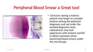 Peripheral Blood Smear a Great tool
• Clinicians seeing a malaria
patient may forget to consider
malaria among the potential
diagnoses and not order the
needed diagnostic tests.
Laboratories may lack
experience with malaria and fail
to detect parasites when
examining blood smears under
the microscope
29-11-2023 Dr.T.V.Rao MD 18
 