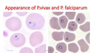 Appearance of P.vivax and P. falciparum
29-11-2023 Dr.T.V.Rao MD 21
 