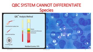 QBC SYSTEM CANNOT DIFFERENTIATE
Species
29-11-2023 Dr.T.V.Rao MD 25
 