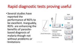 Rapid diagnostic tests proving useful
• Several studies have
reported the
performance of RDTs to
be excellent. Inarguably,
RDTs are enhancing the
benefits of parasite-
based diagnosis of
malaria though not
without problems or
limitations
29-11-2023 Dr.T.V.Rao MD 29
 