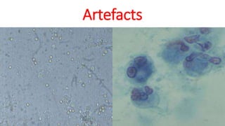 Artefacts
29-11-2023 Dr.T.V.Rao MD 33
 