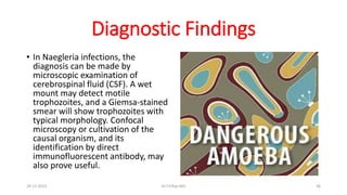 Diagnostic Findings
• In Naegleria infections, the
diagnosis can be made by
microscopic examination of
cerebrospinal fluid (CSF). A wet
mount may detect motile
trophozoites, and a Giemsa-stained
smear will show trophozoites with
typical morphology. Confocal
microscopy or cultivation of the
causal organism, and its
identification by direct
immunofluorescent antibody, may
also prove useful.
29-11-2023 Dr.T.V.Rao MD 36
 