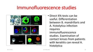 Immunofluorescence studies
• Direct IFA tests can be
useful. Differentiation
between B. mandrillaris and
A. histolytica infection
requires
immunofluorescence
studies. Examination of
contact lenses from patients
with keratitis can reveal A.
histolytica
29-11-2023 Dr.T.V.Rao MD 42
 