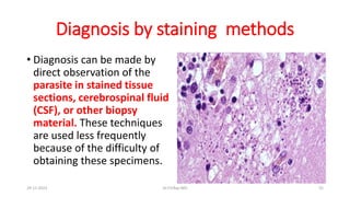Diagnosis by staining methods
• Diagnosis can be made by
direct observation of the
parasite in stained tissue
sections, cerebrospinal fluid
(CSF), or other biopsy
material. These techniques
are used less frequently
because of the difficulty of
obtaining these specimens.
29-11-2023 Dr.T.V.Rao MD 55
 