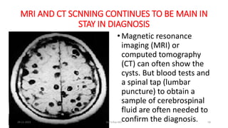 MRI AND CT SCNNING CONTINUES TO BE MAIN IN
STAY IN DIAGNOSIS
•Magnetic resonance
imaging (MRI) or
computed tomography
(CT) can often show the
cysts. But blood tests and
a spinal tap (lumbar
puncture) to obtain a
sample of cerebrospinal
fluid are often needed to
confirm the diagnosis.
29-11-2023 Dr.T.V.Rao MD 58
 
