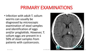 PRIMARY EXAMINATIONS
• Infection with adult T. solium
worms can usually be
diagnosed by microscopic
examination of stool samples
and identification of eggs
and/or proglottids. However, T.
solium eggs are present in ≤
50% of stool samples from
patients with cysticercosis.
29-11-2023 Dr.T.V.Rao MD 59
 