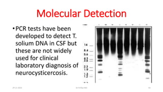 Molecular Detection
•PCR tests have been
developed to detect T.
solium DNA in CSF but
these are not widely
used for clinical
laboratory diagnosis of
neurocysticercosis.
29-11-2023 Dr.T.V.Rao MD 65
 