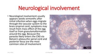 Neurological involvement
• Neurological involvement usually
appears weeks ormonths after
initial infection when eggs migrate
through the vascular system to the
brain orspinal cord; symptoms may
result from mass effect of the egg
itself or from granulomaformation
around the egg. Because the
parasite likely enters the CNS via
Batson’s plexus,the spinal cord and
posterior fossa are the most
common sites of involvement
29-11-2023 Dr.T.V.Rao MD 67
 