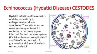 Echinococcus (Hydatid Disease) CESTODES
• Hydatid infection often remains
undetected until cyst
enlargement produces
symptoms. The cyst can cause
more severe symptoms if it
ruptures or becomes super-
infected. Central nervous system
(CNS) involvement complicates 2
and 5% of infections with E.
granulosis and E. multilocularis,
respectively.1,3
29-11-2023 Dr.T.V.Rao MD 70
 