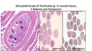 1Encysted larvae of Trichinella sp. in muscle tissue,
2 Babesia and Falciparum
29-11-2023 Dr.T.V.Rao MD 77
 